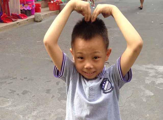 2015��9��26�ţ����˺����Ľ�㵽�����ж�ͯҽԺȥ����ǰ��飬2015��9��30���õ�����������ϸ�2015��11��2�����������ͯҽԺҽ����绰˵���������Ѿ��������ˣ����ڽ������ʮ���·ݳ����й�����ֲ������