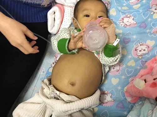 �ڸ��ݵ��صĸ��ױ���Ժ�����汻���ΪӤ�������ۺ�����סԺ������һ�������ڣ�Ҳδ����ת��������ְ��������ϵ�Ǯȴ�����ˣ�ֻ�ô������ص���������µ��������������˻ƣ����Ǳ�����״���ǵ�δ����ת�����ӷ���Ҳ����ˣ������ĸ�ĸ�ִ����浽�˹��ݸ�Ů��ͯҽԺ�������ﺢ�ӱ�ȷ�ﻼ����������