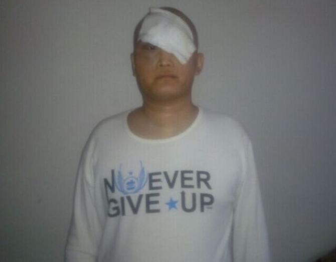 ���ڵĸ��峬����ϸ����ɢ��������ѹ�ȵ���������֯��Ŀǰ��ҽԺ��Ƿ�ѣ��������ٳ�Ժ��