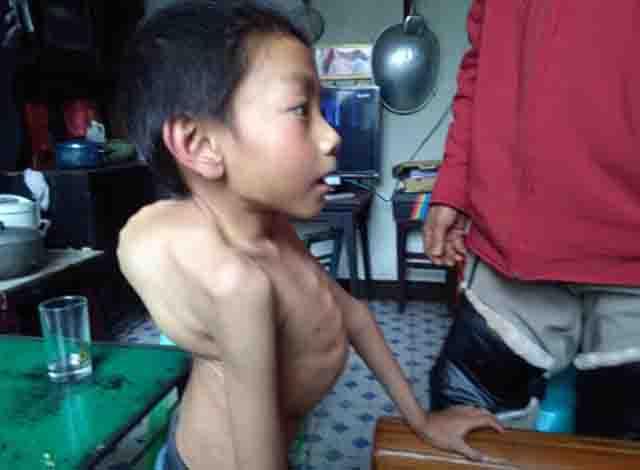 2011��3�£����ҵ���ĸ��������������Ȼ����ĸȥ����ʮ�죬���ҵĽ���ֱ�������˼��԰�Ѫ�������ﲻ�ϵ����˻��������������ƶ���ļ�ͥ��˵��������ѩ�ϼ�˪��������Ȼ��������ң����ڼ��ﻹ�к��ӵ�үү�ͻ����ĺ��ӣ�����������򹤣�ֻ����ũ�������Χ�����˴��㹤��ά��һ���˵����