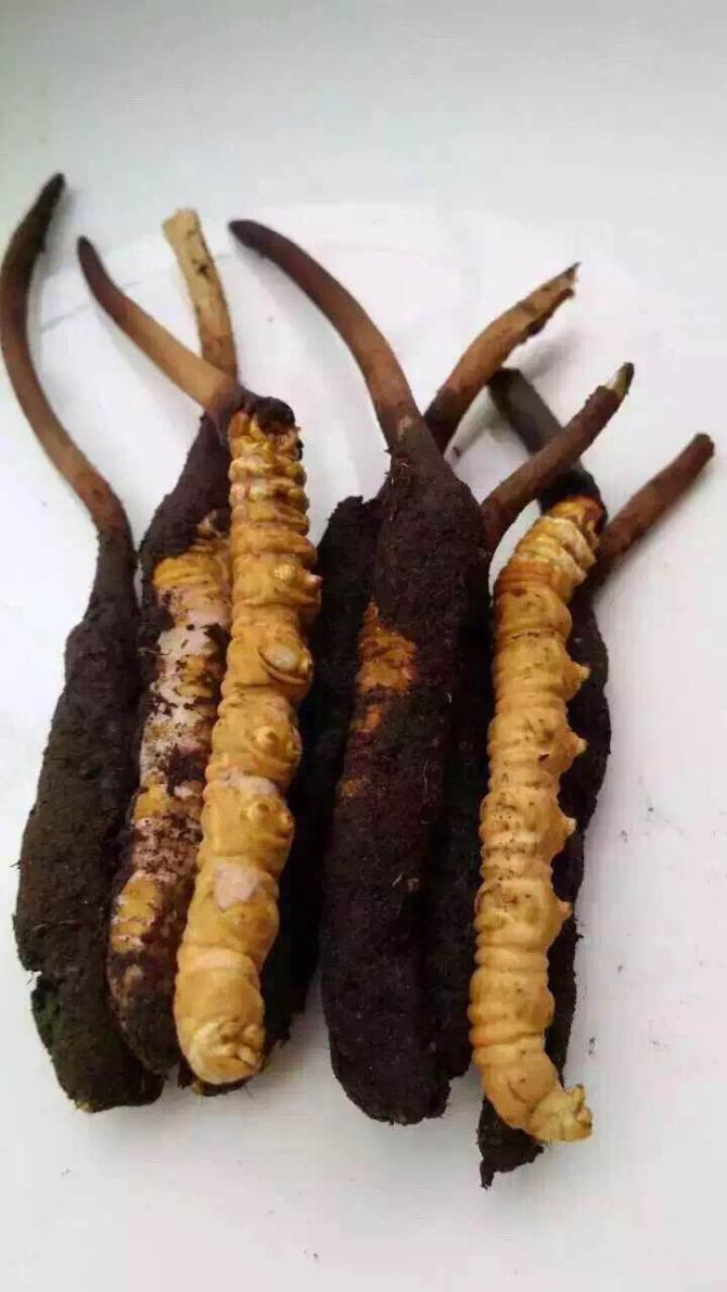 ҽ��˵Ҫ�Ǹ�������û�и�Ⱦ����������һ���¾Ϳ��Գ�Ժ�ˣ����ǻ�Ҫ׼����20�򡣿����������û�а취�ˡ�����������취������ĳ������ȥ��ЩǮ�����������ƣ���������ļ��15����������ڵ����Ʒ��ã�ϣ������ܰ���ҵĶ��ӣ�����˳���ȹ����һ�ء�лл��ң�