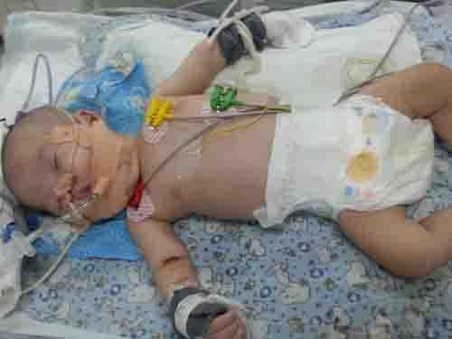 Ϊ�˼��ٷ��գ�ҽ������ڶ����������һ�α�����3���¡�Ϊ��ι����С����ֻ�ܴӱ��Ӳ������ڷ��ÿճ�Ӫ���ܡ����þ�������С���෴����������39.9�ȣ����й������ݿˣ���鱨��������˫���ѱ���ˮ��ʴ�������Ѿ��޷�����������ҽ��˵��С�ಡ��Σ�أ���Ҫת�����õ�ҽԺ���ƻ�������һ��������