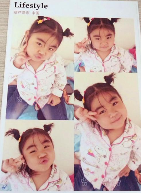 ���õĲ������תΪMDS, ���뾡����������ֲ�����������񻯳ɼ��԰�Ѫ�������������ơ����Ǿ������ϴε��������Ǽ��Ѿ�û��������Ϊ��������ֲ�����ˣ�һ����Ϊ�����Ʒ�һ��Īչ��