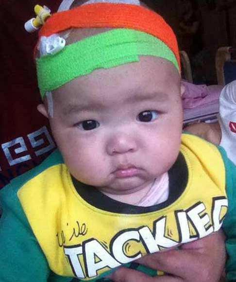 �������ٴδ�������ȥҽԺ��飬����ѪС������û����������ҽ���Ľ����£�����̤����ǰ�������ĸ������ڱ����ٴν����˳�Ѫ���顢�Ǵ���CT�ʹŹ���ȼ�飬ҩ������һ���£�ѪС����δ������