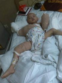 ���Ѿ�½��������6��ֲƤ�����ˣ�������Ϊ��Щ���ֵİ̺����⣬��������Ҫ�������а̺��ɽ������ſ��ԡ� ��������һֱ���ں������ߣ��ְּ�������׬ȡ���Ʒѣ�һ������2000-3000Ԫ�����롣