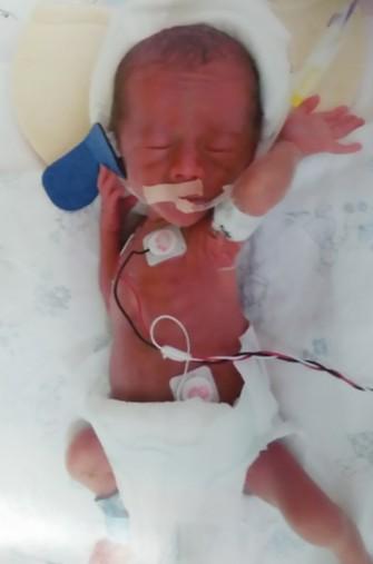 ���������ϵ�˾Ȼ���������Դ���͵��˱����������ҽԺ��ԭ�ڶ��ڱ���ҽԺ����תԺ֮����Դ���̱��ͽ�����֢�໤�ң���Ϊ����������෢������ȫ�������Ƿβ��������˺�������ͬʱ��Դע���˴ٽ��β�������ҩ����