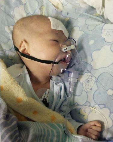 ���ӵĸ�ĸÿ��ֻ�ܸ��Ų���������һ�ۣ�������ôС����û�г��Ͽ��̣�����ôһֱ���ź����������š�����ҽ��˵�������ܳɹ���ֻ�Ǻ��ӻ��е���ף���Ҫ�ٹ۲�һ��ʱ�䡣һ���º��Ӵ���θ�ܻؼ��ˣ�ҽ��˵�Ⱥ��ӵ����ʹ��ָܻ����ٳ���θ�ܸĿڳ��̡�