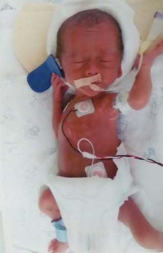 ��Դ�����������ĺ�ת���������س�����1.14kg��������������Ҫ����5����ܵ����Ժ��ˮƽ����Դ�����Ѿ������˺�������������0.5ml��ι�̣�������Ϊ���ֺ�����ͣ����������Դ������Ȼ�޷���ʳ��ʹ��Ӫ��Һ���ơ�