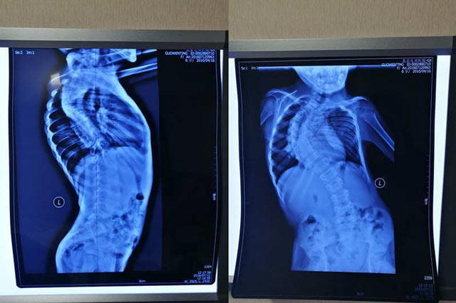 ����һ����������ײ��ũ�壬������ΪŮ�����������������˼������еĻ����������ھӿ������Ƕ�ԶԶ���š��������û���һ��13��Ľ���ڶ�������ҪǮ���ܵ��ڶ��׶�԰Ҳ��ҪǮ�����ðְ��Ǹ��غ����,�����в��⼸�������Ҳ�Զ�İ������ϸɻҲ�����˼���Ǯ��