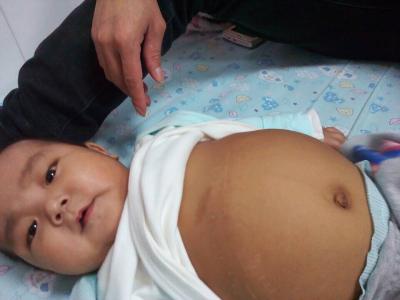 ���𱦱� �Գ�껣����� һ������û���ü����ˣ�����ͱ���ϳ��������Ե������������˸������������������Ӳ�û�к�ת�����Ƿ��գ���������ȥҽԺǰ���˼�ʮ��