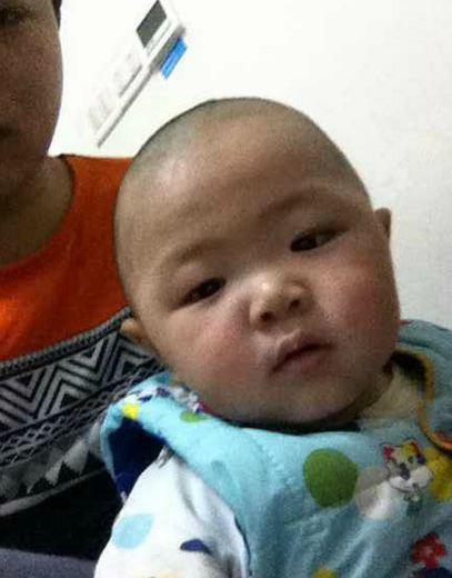 ����5�·ݱ�����ͯҽԺ��绰���߻�������ҽ�������Ŵ���&ldquo;��ĺ�����һ�ַǳ������ļ�����was��ʪ��ѪС����ٰ�����ȱ���պ�֢��&rdquo;����������ȥ�������ڽ��ڸ��������ơ��Ŵ�������仰�·𿴵���ϣ�������Ƿ��������̶����������ͯҽԺ�ҵ����ڽ��ڣ��ڽ���˵ֻ������ֲ���Ӳ���ȫ����