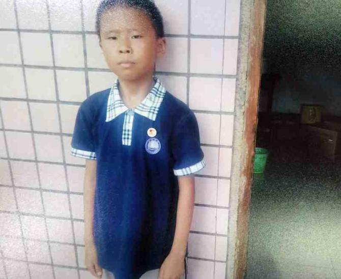 2016��1��17�����ϣ�־���𴲺�ͽ���ʹ������������·�������ѣ������������������������£��Ѿ����յ���ʮ�ȣ��ż�������Ͻ��������͵��������еڶ�ҽԺ������ҽԺ־�µ�����֫�Ѿ��м������һ���׿��ˣ�ҽ���Ͻ���־������Ƭ�����˼�飬����û��ʲô�쳣������Щҩ�ͳ�Ժ�ؼ��ˡ�