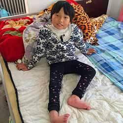 �����ѵ��»���֫�����ػ��κͶ��ֲ���֢����֫��м����������ѡ���ʹ���Ⱥ��֮һ���ҹ��Ǽ����ѷ�������ߵĹ���֮һ�������ѵ��»���֫�����ػ��Ρ��������ѡ��о��������衢����ʧ���ȣ�����Ӱ����һ����ѧϰ����ҵ�����