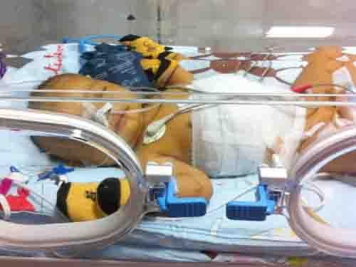 ���ſɰ���Ů��һ���쳤�󣬰ְ������ֿ��˻����������ӳ�Ժ10������Ƿ��ֱ�������ɫ�ɰ�ת�ƣ��ɵ���ҽԺת�����������һ����ҽԺ��ҽ���������˻�ҩ���ú��ӻؼҳ�ҩ�ٹ۲죬��������ؼ��Ժ󾭳���ҹ���֣����Ҳ���������ɫ����ĸ���ò��ҵ��飬�ٴδ�����ȥ��ҽԺ��