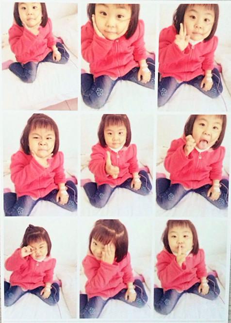 �����ַ����˱�����ѡ�����������һ��ҩ��ATG���ơ�  ���ƿ�ʼ��ʱ������Ҳ�ǳԲ��¶��������ش������룬3��4����֮����Ҫ��Ѫ��ѪС�塣�ڱ������ư�������Ǵ������ûص��ϼҳ���ҩ����ҩά�����ơ�����������ǻ���30����Ԫ����ʱ���������˷��ӻ���һЩ�أ������������ѡ�