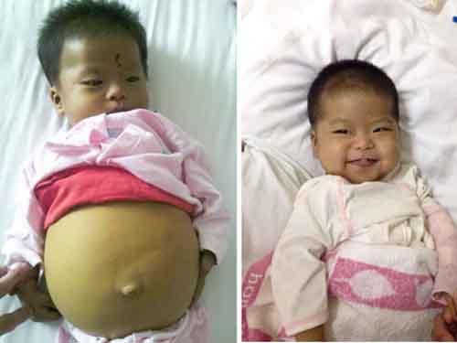 ���������Խ����ı��������Ǹ�ĸ��������ŵõ��ı���Ů�������һ��˵�������������ᶨ��ξȺ��ӣ���񾧾�����ʹ����&ldquo;�¸α���&ldquo;��Ŀ�������£��Ѿ���ɸ���ֲ����8���¡�