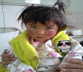 2015��9�·ݣ��ɶ�������ҽԺ������������չҽ��Ѳ��ʱ���ֹ�5��������Ҫ���쵽ҽԺ���ƣ�����Ϊ�� ������ķ,Ů����3�꣬�������������ذ����磬�������������ಡ����ȱ�������رղ�ȫ���жȣ��ȣ���Ҫ��������Ԥ��3.5��