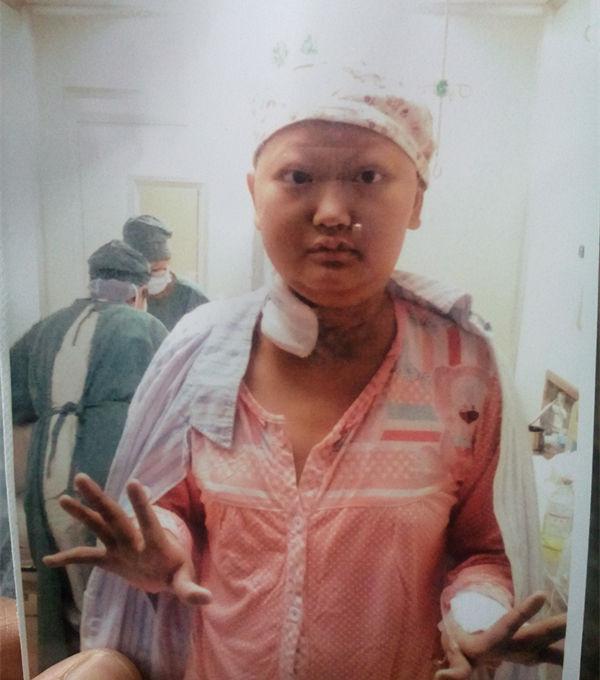 ����������ʱ��δ��17�꣬����������������ͣ����ʹ������ƣ���һֱҧ����֣��ǳ���ǿ������λ����ڹ��軺���������2014����ף��������ѵľ��ð������ɵܵ���Ϊ�������˰���ϸ�ϸ����ֲ������