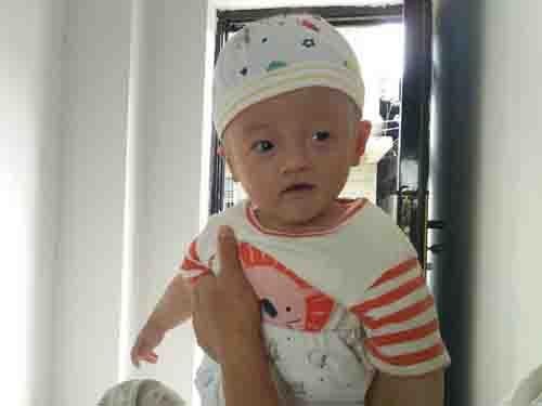  2015��12��14������11�㣬����÷�ڽ���ʡ��Ϫ������ҽԺ˳������һ���к��ư��ϣ�����ڳ�Ϊ�˸�ĸ������÷����������ϲ���콵����С���ϸ���������ɫ���ֲ�����������Ҳ���������߳Ա��£�������㣬��ҽ����鷢���������Բ�������ط�ҽԺ���������޷�ȷ���������ת�ϼ�ҽԺ��