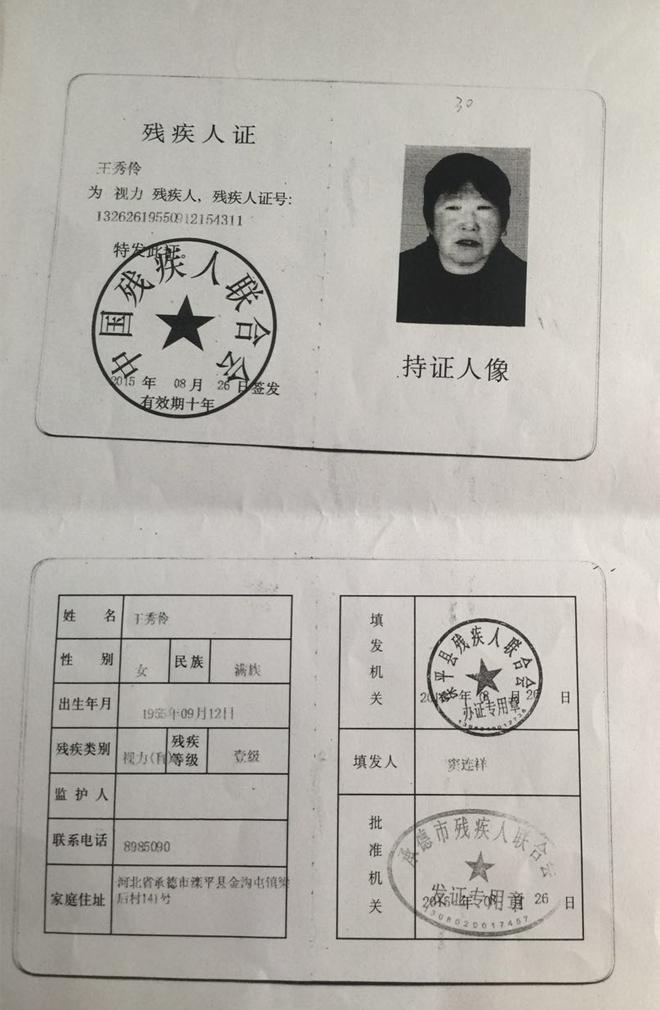 �������£�������������ͬ�Լ�����������ҽԺ���ܽ�Ĥ��ֲ���������ƽ�ĤӪ��������ϸ�ĵĽ�Ĥ������Ȩ��ר������ΰԺ���۲쵽�����̵�����Ҳ�ǳ�����������ֻ���ֶ�����������ֻ�ܿ���ָ�����־���һϵ��רҵ�ļ����ϵ�֪��������ͬ�����м����ԵĽ�ĤӪ����������Ҫ���н�Ĥ��ֲ�� 