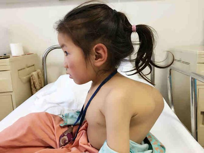 �������س���8��ʱ�ҳ��������ĺ󱳺��������ӵĲ�һ�����Ѿ�7���������ȥֻ��3��4�꺢�ӵ����ߡ�������������Ӳ���Խ��Խ���أ����ߡ�����ͷι��ܶ��ܵ��˺ܴ��Ӱ�죬��ʱ����·������ز����ơ��粻��ʱ���������Խ��Խ���أ�ѹ����֫�񾭣�����̱������Ӱ��������