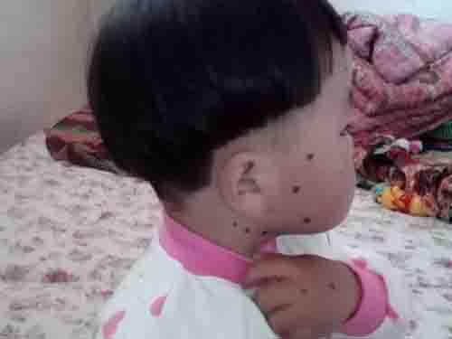 ��ĸ�෽��ҽ�˽⵽�����ֲ���Ϊ&ldquo;������Ƥ��&rdquo;���������Ժ���ϸ�����е�һ�֡�����ϸ�����С��һ�����ֱ����20cm���ϣ���Ϊ�޴��ͺ���ϸ���룬���ֲ�����Ӱ�캢�ӵ������������������м���Ŀ����������䣬���Ʒ��úܸߡ������ں��Ӳ������£�����ֿ�����������һ�������ҿ�ʼ���ơ�