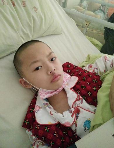 ʯ������Ϊ���ƣ�ͷ���Ѿ����ò���ˣ������������С�к����ڲ��������С�����ܽ���&ldquo;С���&rdquo;�����򲻰�˵��������סԺ�ڼ俴�����ʱ�䣬��Ϊ��Ⱦ������Щ��ŧ�����ھ�������Ҳ����������ÿ���Ƴ̶�Ҫ�������͹Ǵ���ʯ������ס���ޣ�ʯ�ַ����������ʹ��