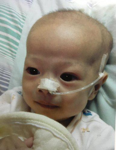 9��10�ճ�Ժ���ĸû�뵽���ǣ�����Ϊ�����������������ĺ��ӣ��ֳ������µ����⣺�����ֿ�ʼ���գ�̵�࣬�������١���ĸ���ò�֪������Ǻã�����֮�£����Ǳ��ź��ӱ����Ϻ���3��18�պ���ת���Ϻ��»�ҽԺ�����ں��ӵ������ڴ󣬵����ʱ�䳤���β���Ⱦ���أ�Ҫ�����Ʒ��ף�Ȼ������������