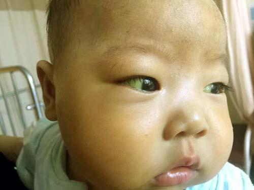 �������Ϻ���������ҽԺ�����������Ƚ϶࣬����һ����̤����ȥ���Ϻ��Ļ𳵡��ڸ�������ҽԺ����һ�����󣬱��������ڳ������82���ʱ�����˸�����������������ĺ�����Ȼû���˻ƣ����ӳ������������ˣ�һֱ��������С�����ޣ����˼���ϣ���ĸ����������ڴ�����������ڣ�Ҳ��ʧ�ܸ����ˡ�