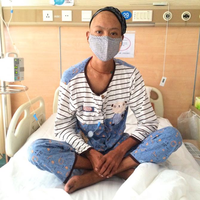 ����20�꣬��һ����ô�������µĺ��Ӱ������õ�Ц�����ǹ������,ȴ��֪������·��˵Ŀ����������᲻���������ӵ����������뾡������������ɰ��ĺ��ӡ�ҽԺ���������������ƣ�Ҫ�ǲ��ϻ��ƵĻ����ǲ������Ӷ񻯣����ڲ�������,ҽ���������ǣ�Ҫ�뺢���ܻ���ȥ���ͱ����Ƚ��л��Ʋ�������ֲ��