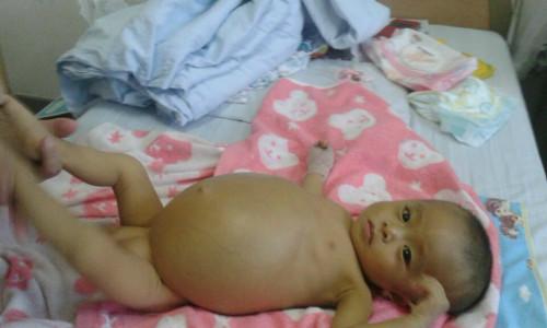 ���𱦱�½���ȳ����ڹ����ϵ��أ������Ϊ���������������ܵ��̼������ಡ��������Чȥ����