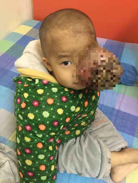 ������������ҽѧԺ�����ڶ�ҽԺ�Ľ����£������������Ӵ���С�����Ⱥ󵽴����ʡ�����ڶ�ҽԺ��ǭ������418ҽԺ����������ҽԺ������ҽѧԺ��Ѱ�����ƣ��õ��Ļظ����ǣ�����̫���޷�Ϊ��������ƣ����鵽����������ȵص�ҽԺ������