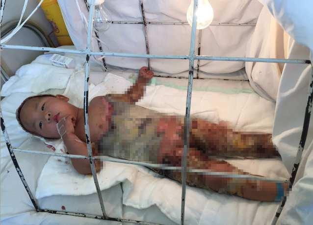 ʩ��������һ��6�ڵ�ũ���ͥ���Ҿ�ƶ����үү���屡����������Ҫ��ҩ�����̺����趼���ڼ���ũ����������л���ֻ�������ںƺưְ�ÿ�²���2000Ԫ��������ά�֡�