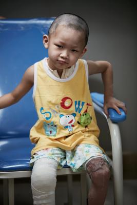 ��ֳ���޸���15000һ����Ҫ�����Σ�����30000Ԫ��ֲƤ������ÿƽ������30Ԫ����Ҫ��800ƽ�����ף�����24000Ԫ�������룺7000Ԫ����Ѫ��7000Ԫ���䵰�ף�4000Ԫ��סԺ�ѣ�4000Ԫ�� ����76000Ԫ����ͥ�Գ�26000Ԫ������ȱ��50000Ԫ�� 