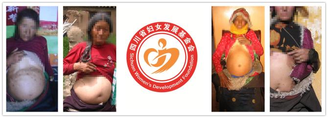 ʯ���ػ����没��ƶ����Ů����