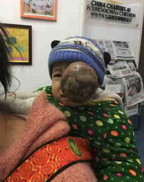 ҽԺ���������������Ŀǰ���Ӳ����Ϊ���أ�����ܴ������������Ϻ��ȵصĴ�ҽԺ���ƣ�������ܻ��һЩ�����ܻ����˼���Ļ����������δ����ϣ����2016��3�º�����һ�𣬴��ź���ȥ�˱��������˱�������������һλ������ʿ����ֽ�����͵���9958��ͯ�������ģ�ϣ���ܹ���������취��