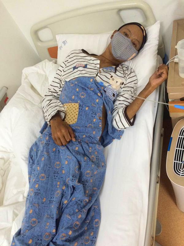 ����ȴ���ڲ����ϣ������Ų�ʹ����ĥ�����Ƶĸ������Ǻܴ�ģ��������ѷ���Ż�£���ʱ��һ��һҹ���³�θҺ�͵�Һ���¹�֮��ü��첻�ܳԷ���һ����˶����ѳ��ܣ����ǿ��������ĸ������Ӻܼ�ǿ��һֱ������ơ�