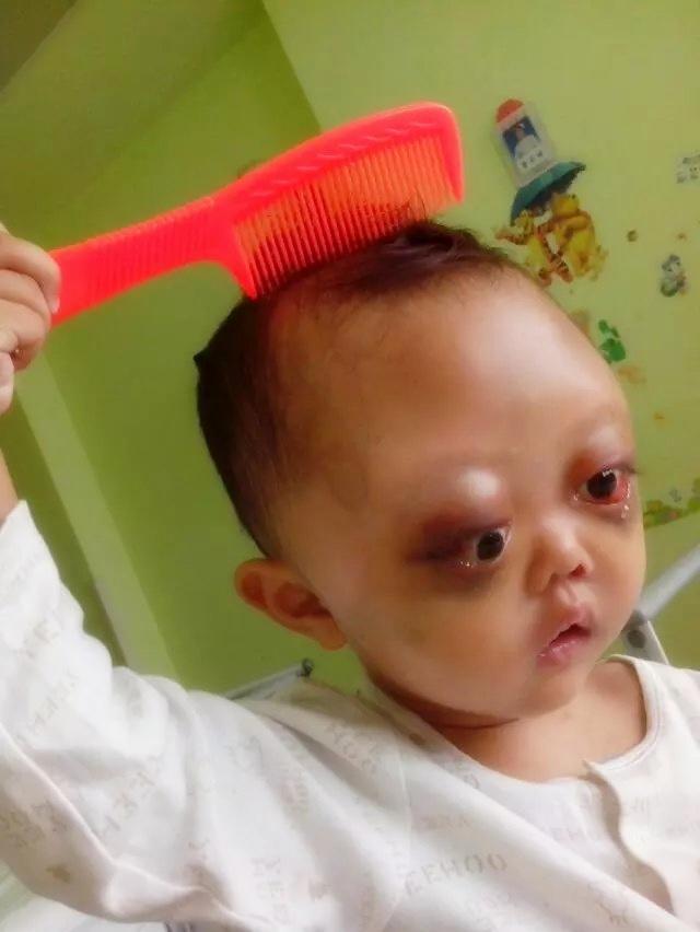 �����ִ��ź��ӿ�ʼ����֮·�����������ڱ���ͬ��ҽԺ���ƣ���������ɢͷ�������׵����Сɽ��������Ӱ�캢�ӵ����������������ڵ������Ѿ������һ������С���С�ÿ�γ��Ŷ������ҵ��������ĵĶ���˵�����裬���ǲ��Ǳ�úܳ��ˣ�С�����Ƕ������������ˣ�