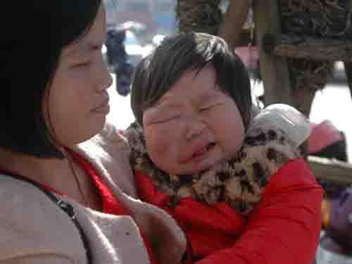 ������·������ͨ������������ϻ����ǿ��µ�Ѫ�������ⲡ���ܸ��Σ�ֻ�ܿ��ƣ�ԽС����Խ�á�10���µ�ʱ��ĸ����С����ȥ��ʡ��ҽԺ������ȫ����Ͳʳ�����Ͻ��ȷʵ��Ѫ������ҽ����ʾ���������������ޣ�����ȥ�Ϻ��ھ�����ҽԺ��Ѫ������ȫ����õġ��ɵ�ʱ���������ʵ�ڲ�����ȥ�Ϻ����ơ�