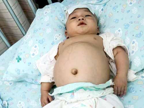 ��εĸ��������������˼������еĻ�����Ÿ��������˼�����˼�����Ͻ�������5ǧԪ���������������Ϊ��Ժ�Ժ��ܹ��ָ����������첻����Ը���ؼҵĵ����漣�Ϳ�ʼ���գ������ѵĸ�ĸֻ���ִ����ػ�ҽԺ��������ôС�ĺ�����˵�����ƵĹ��������ʹ��ģ�ÿ�����룬�������������漣һ��ޡ�