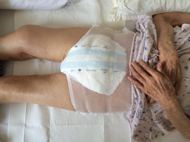 ������ΪԺ��52λʧ��ƶ�����˳Ｏһ�꣨365�죩��Ƭ�� 52*7*365=132860Ԫ ��Ŀִ�з���6993Ԫ ����139853Ԫ��ִ�л���������к�ͯ���깫������