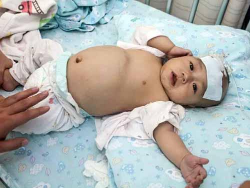 �漣����ȷ�ﻼ�����Ե���������ҽ��˵���ӿ��������������������⣬���Ч�����ã�����Ҫ������ֲ���������������Ϣ���漣��ĸ����֪����ش�����ҽԺ�ſڵ�̨���Ͽ�������Ȼ���������ĳɹ���ֻ��30%�������ǻ��Ǿ�������������ֻ���������µ�С�漣������ICUס��20�졣