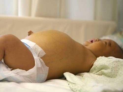 �׶�������ͨ����֭�����ţ���������ʹ�����ǵ����������粻��ʱ������ֲ����������һ�㶼���һ��ͻ�ز�ۣ�������������С����������ص�����ϵͳ������ֻ��ͨ������ֲ������������Ⱥ��ӵ�������