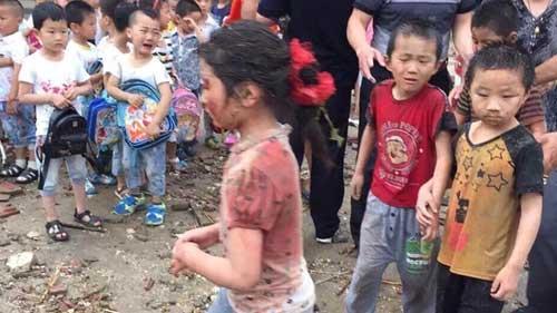 ����Сѧ��¥�ķ�����쫷��������߸��������ˣ���ҽԺ���ȡ����������϶�����ͺ;��壡