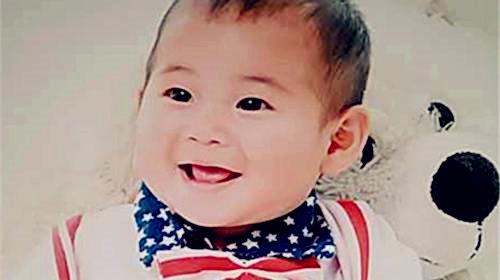 Ȼ������������ͻ��������2015��6�£����ȸ���1�꣬���˷������Ķ����и��׿飬ȫ��Ƥ�����ƣ����۰�Ҳ���ˡ��Ͻ���С�ȵ��Ϻ�����ҽѧԺ�����»�ҽԺ���������Ϊ�ʸ�ϸ����֯ϸ������֢�����ȸ�ĸ������˲�������