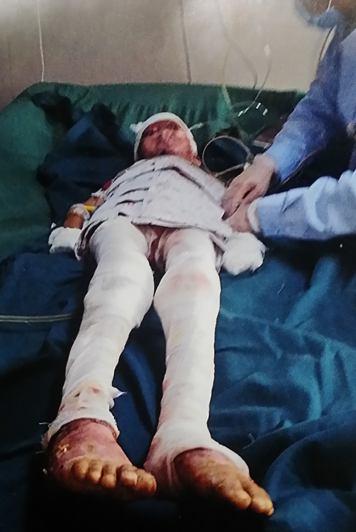 �������ǸϽ�������ɽ�鿴����ǰ������һĻ�Կ�������������������·��������黹�Ƿ����ˣ�����ȫ�����պڣ����ڵ���һ���������������������ˣ��Ͻ������ӱ���ɽ������������ҽԺ���ȡ�