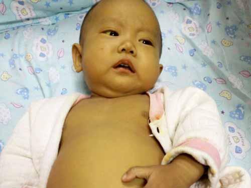 ����ȫ���˶�������ϲ��֮��ʱ��ȴ���ֱ������Խ��Խ�Ʋ��Ұ��п��ֲ��ϣ���ͮ�ĸ�ĸ���̴�������������������ҽԺ��飬�����ʾ����ƫ�ߣ���Ƣ�״�סԺ����ʮ����δ����ת