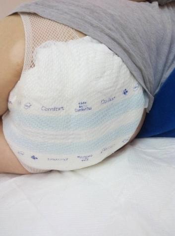 ʧ������ÿ������Ҫʹ��2Ƭ��׼������Ƭ��ÿƬ3.5Ԫ��������ͨ��ͥ�����п�֧�������Ƕ��ڶ�����Щ�¹ѡ�ƶ����ʧ�����˶��ԣ�ÿ��7��Ǯ����Ȼ��һ���ܴ�����֡�