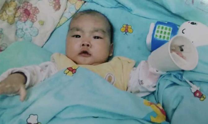 ���ʤ˵������סԺһ�����º�����û��һ���ת��ҽ��˵�ȱ������ƣ�ÿ���¶��������һ�Σ����Ӵ�һ����ȥ�����ͯҽԺ�������ƣ����ʤ���������������ź��ӷ���סԺ���ơ�