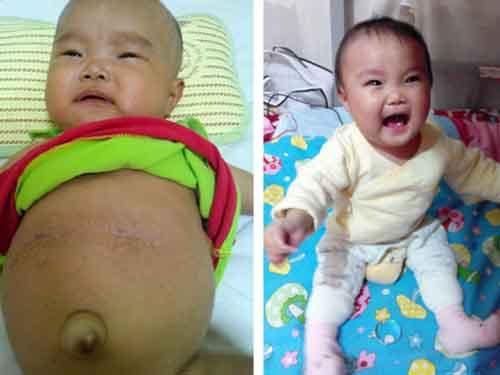 ӨӨ����������һ�����¸α�����Ŀ֧���£�˳����ɸ���ֲ�����ĺ��ӡ���������������Ĵ�ũ�壬�����ʱ��ȷ�ﻼ���������������Ѿ���Ӳ������ˮҲ�����أ�2014��11�£�ӨӨ1������֮ǰ�����˸���ֲ�����������ѽ�һ��ʱ�䣬�����Ѿ��ص����磬��ְ�����һ�������Ҹ���������һ��